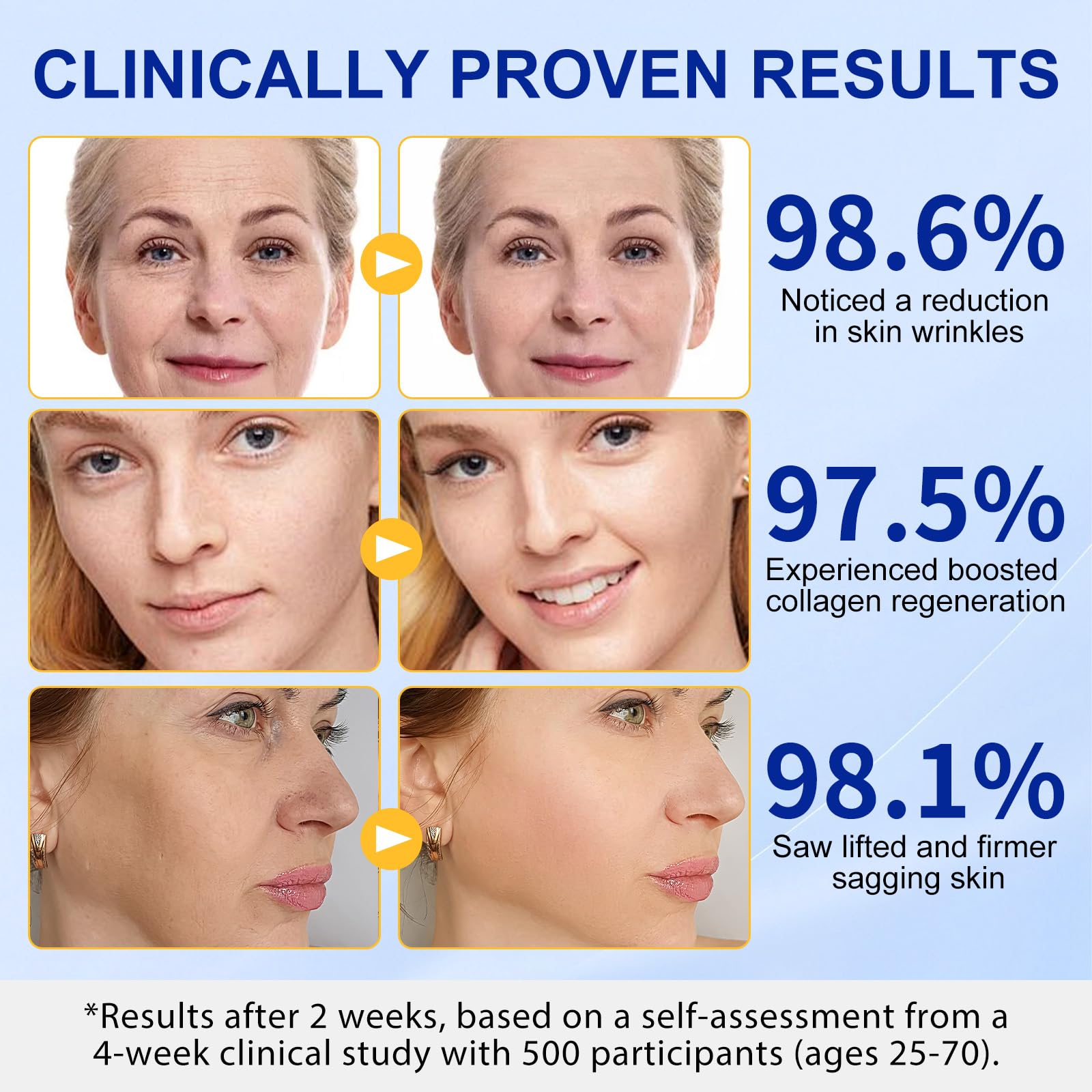 TKTALKER Firming Target Wrinkles Laugh Lines concentrates action on problem areas