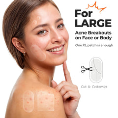 TKTK 45x45 patch on chin or forehead for versatile large-area protection.