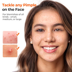 TKTK hydrocolloid formula provides gentle protection on active spots.