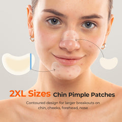 TKTK chin-patch-halfmoon-038x026mm focuses on precise coverage for clusters