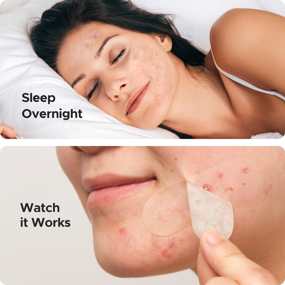 TKTK 10mm spot patch for medium-sized blemishes with flexible fit.