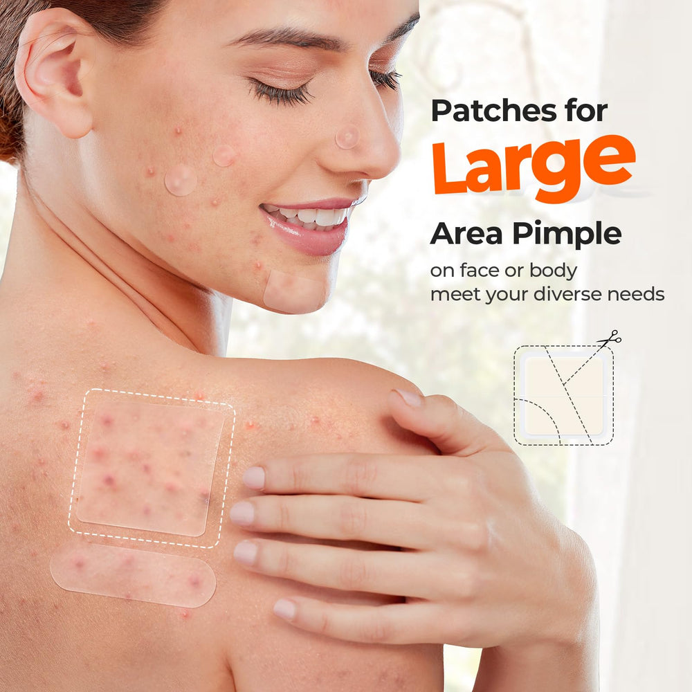 TKTK 8mm spot patch for precise blemish coverage.