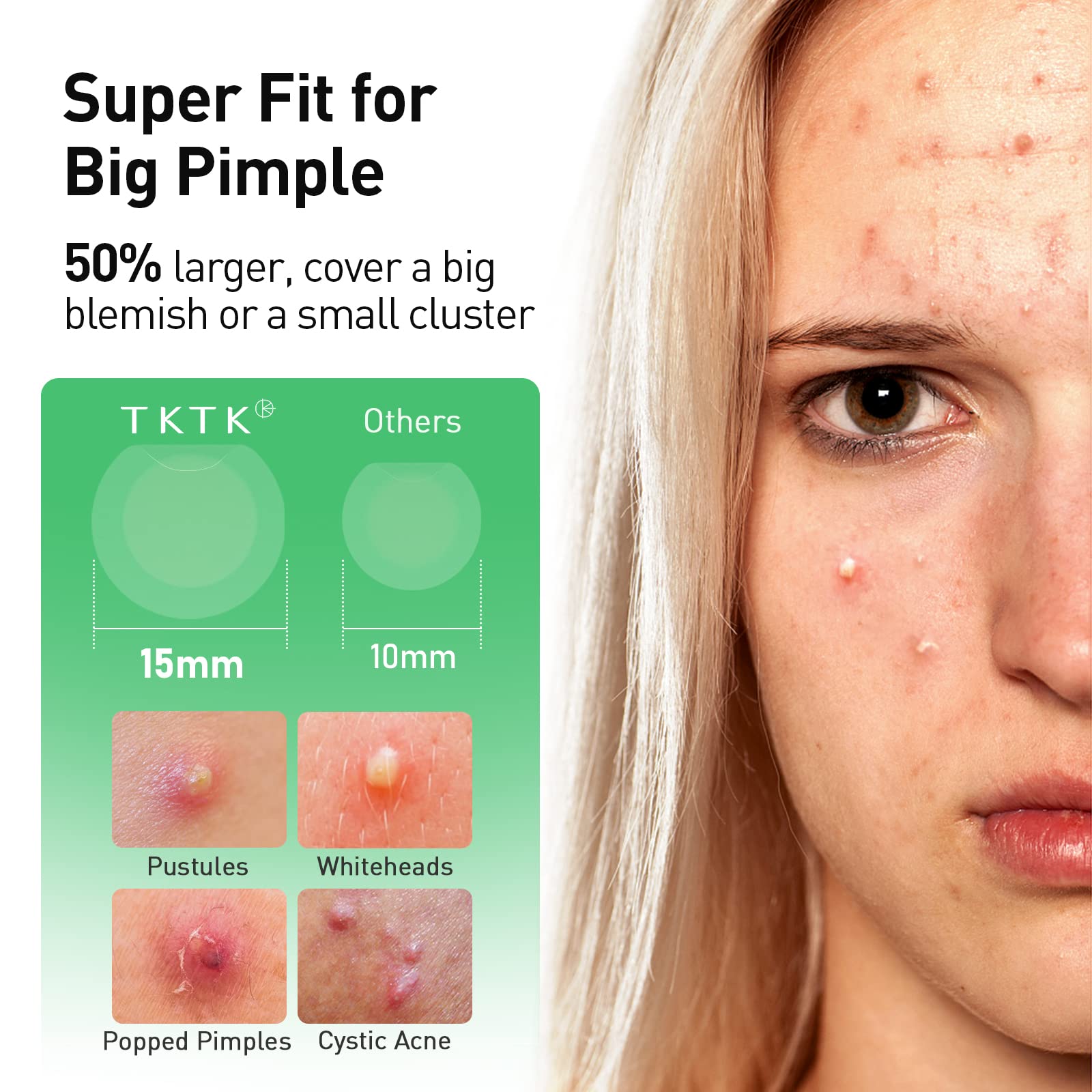 TKTK Pimple Patch applied to skin demonstrates near-invisible coverage.