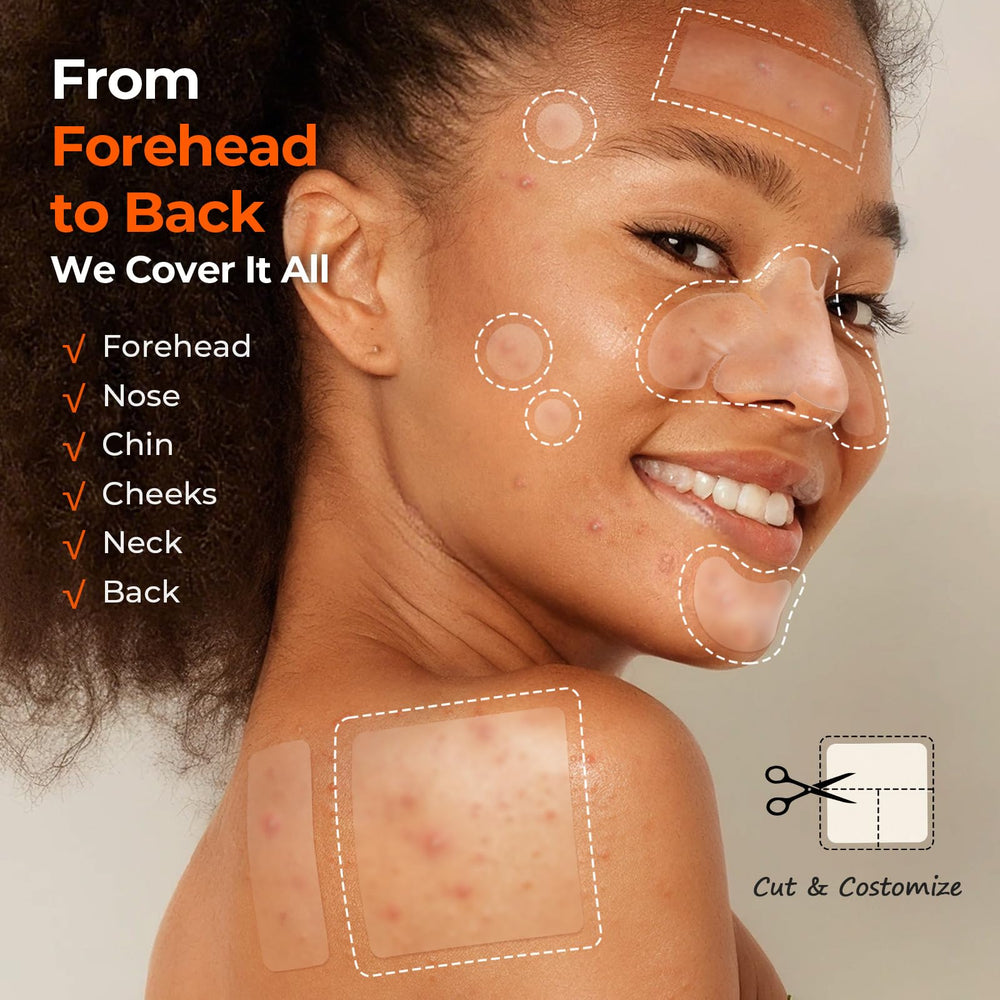 TKTK Pimple Patches large back and cheek patches for bigger breakouts.