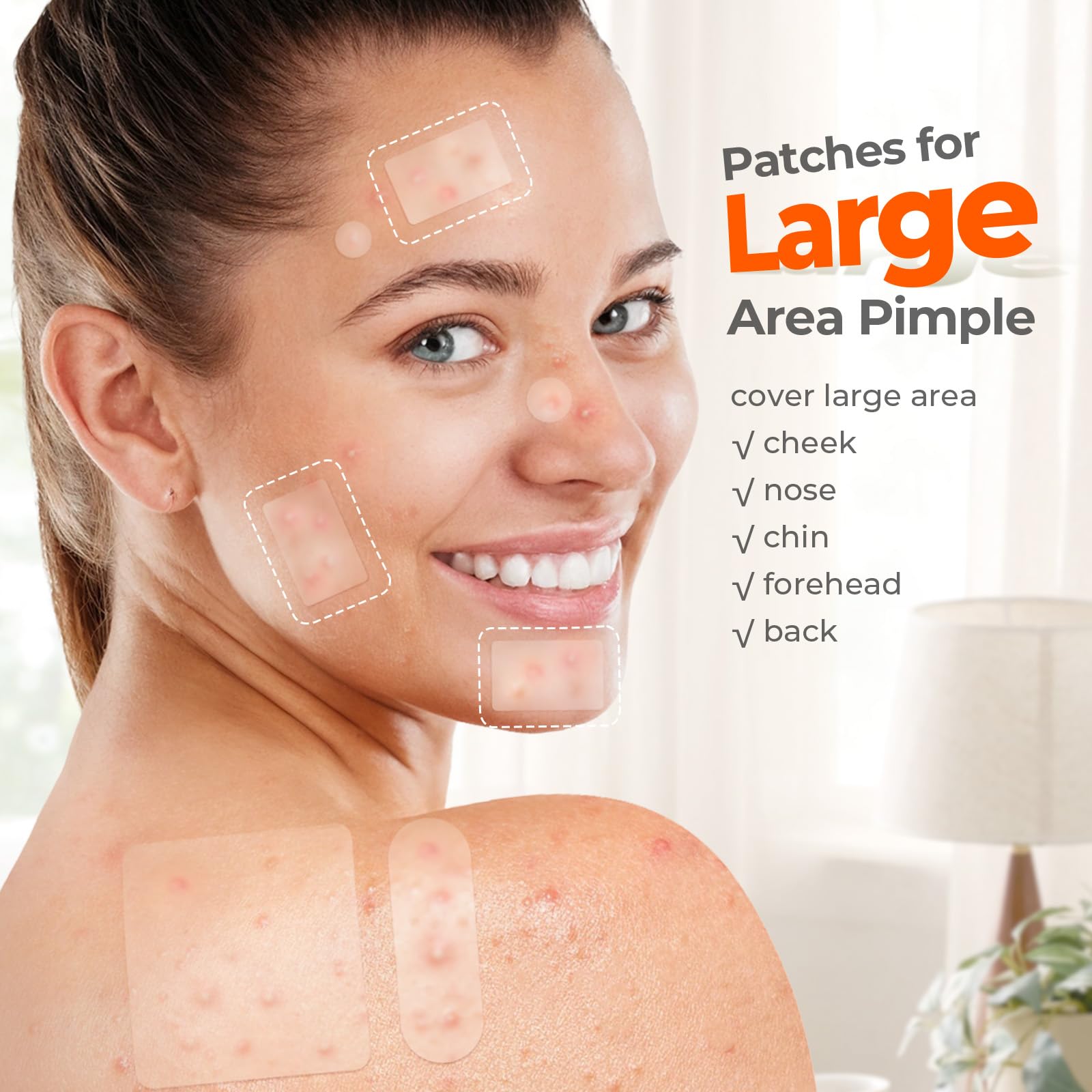 TKTK patches on chin, forehead, and nose illustrating precise blemish fit