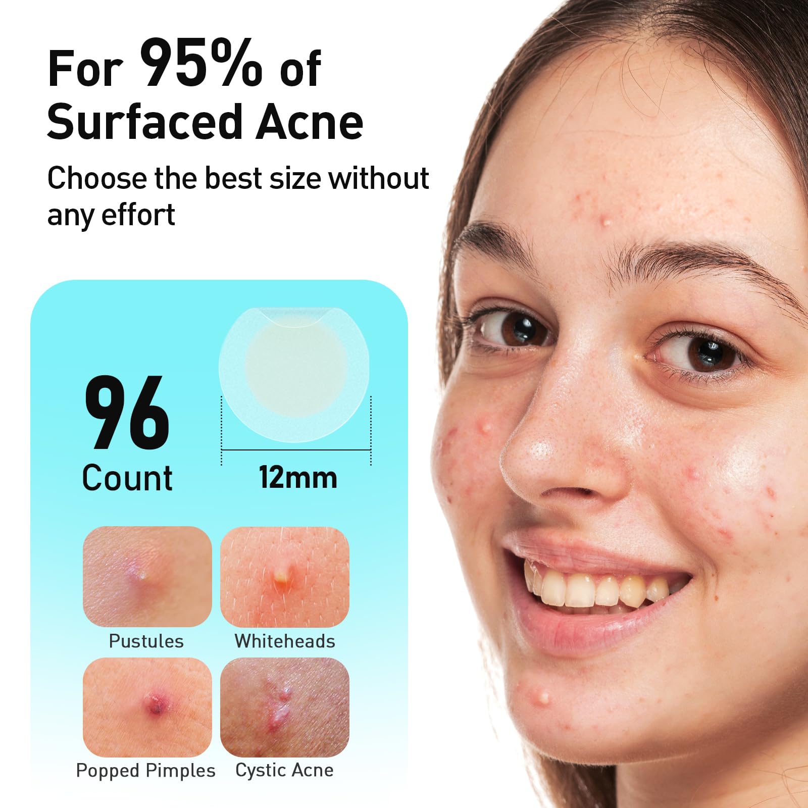 TKTK Pimple Patches easy peel-off design demonstrated.