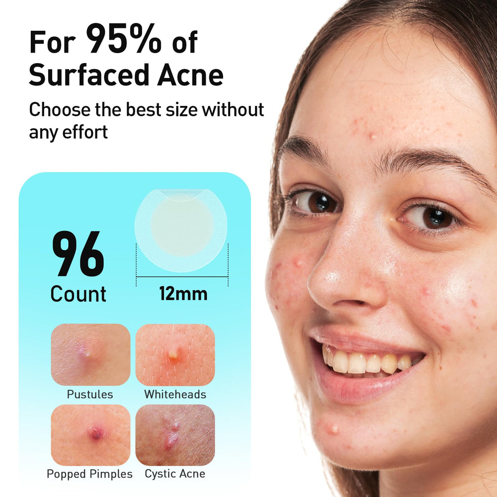 TKTK Pimple Patches easy peel-off design demonstrated.
