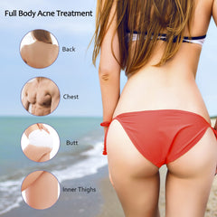 Tobcharm acne-prone body lotion for back, butt, and thighs promotes smoother skin.