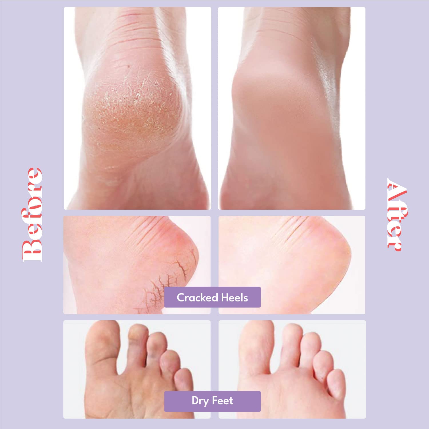 TOI:L extra silky foot mask pairs ready for pampering sessions at home.