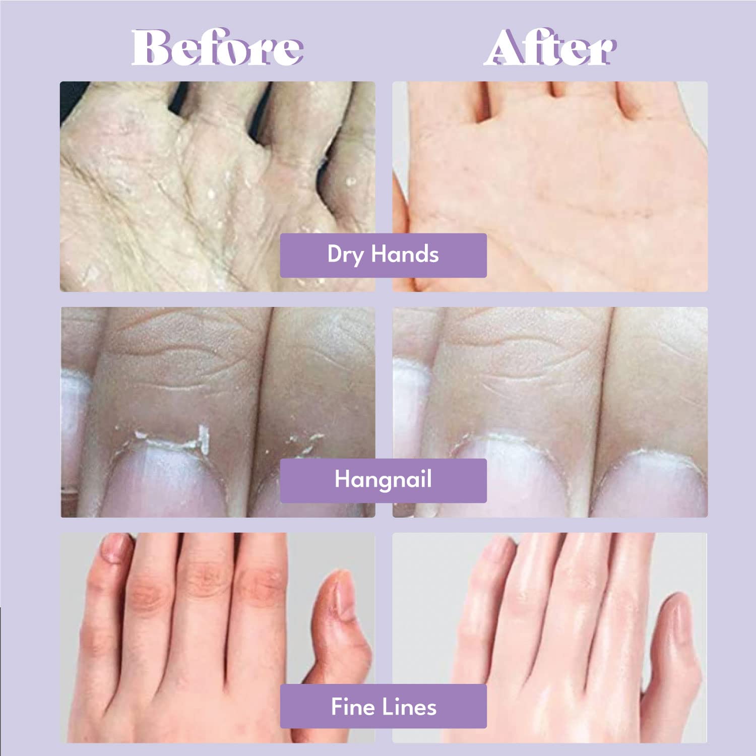 Application process of TOI:L Extra Silky Hand Mask on hands.