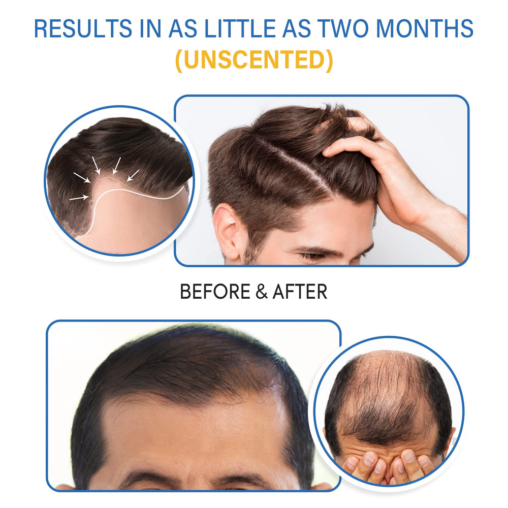 Tomum Minoxidil Foam after shower use fits into daily regimen