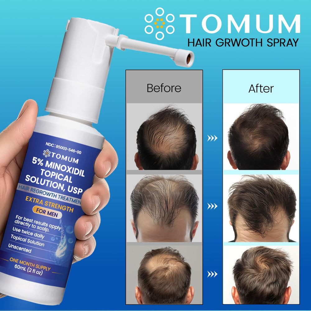 TOMUM non-greasy, fast-absorbing spray shown on scalp