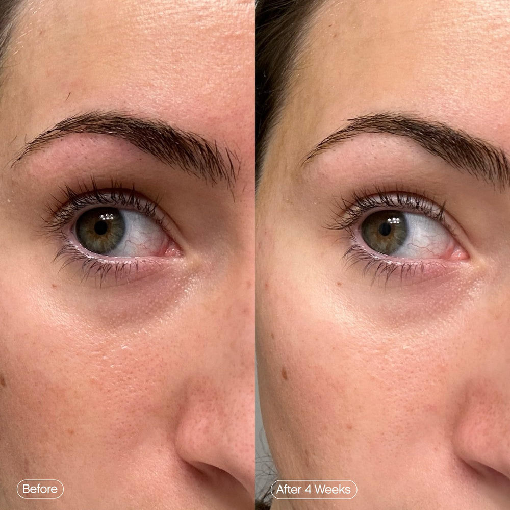 Topicals Faded ingredients: kojic acid, caffeine, and niacinamide