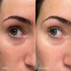 Topicals Faded ingredients: kojic acid, caffeine, and niacinamide