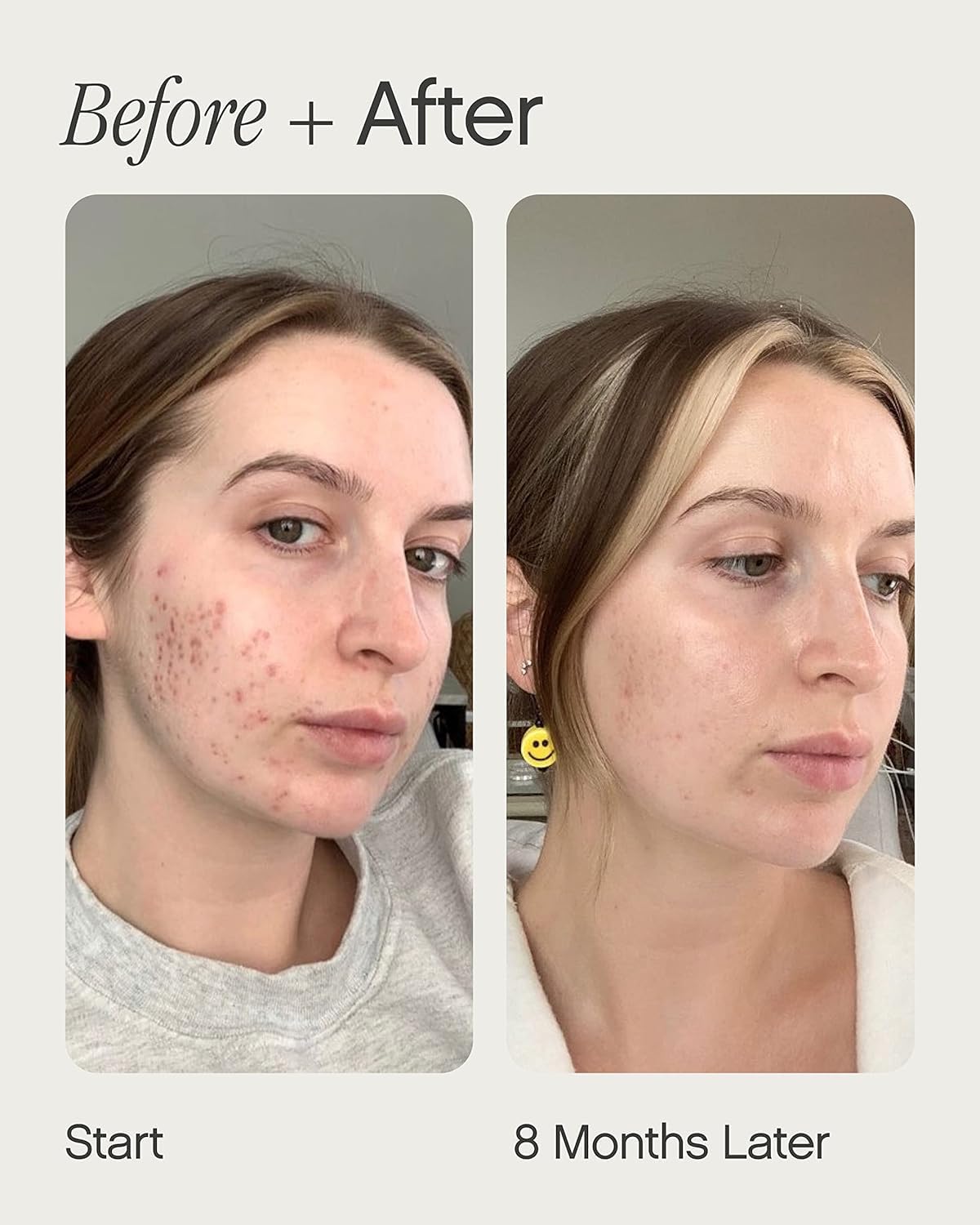 Topicals Faded serum applied to clean skin for gradual fading.