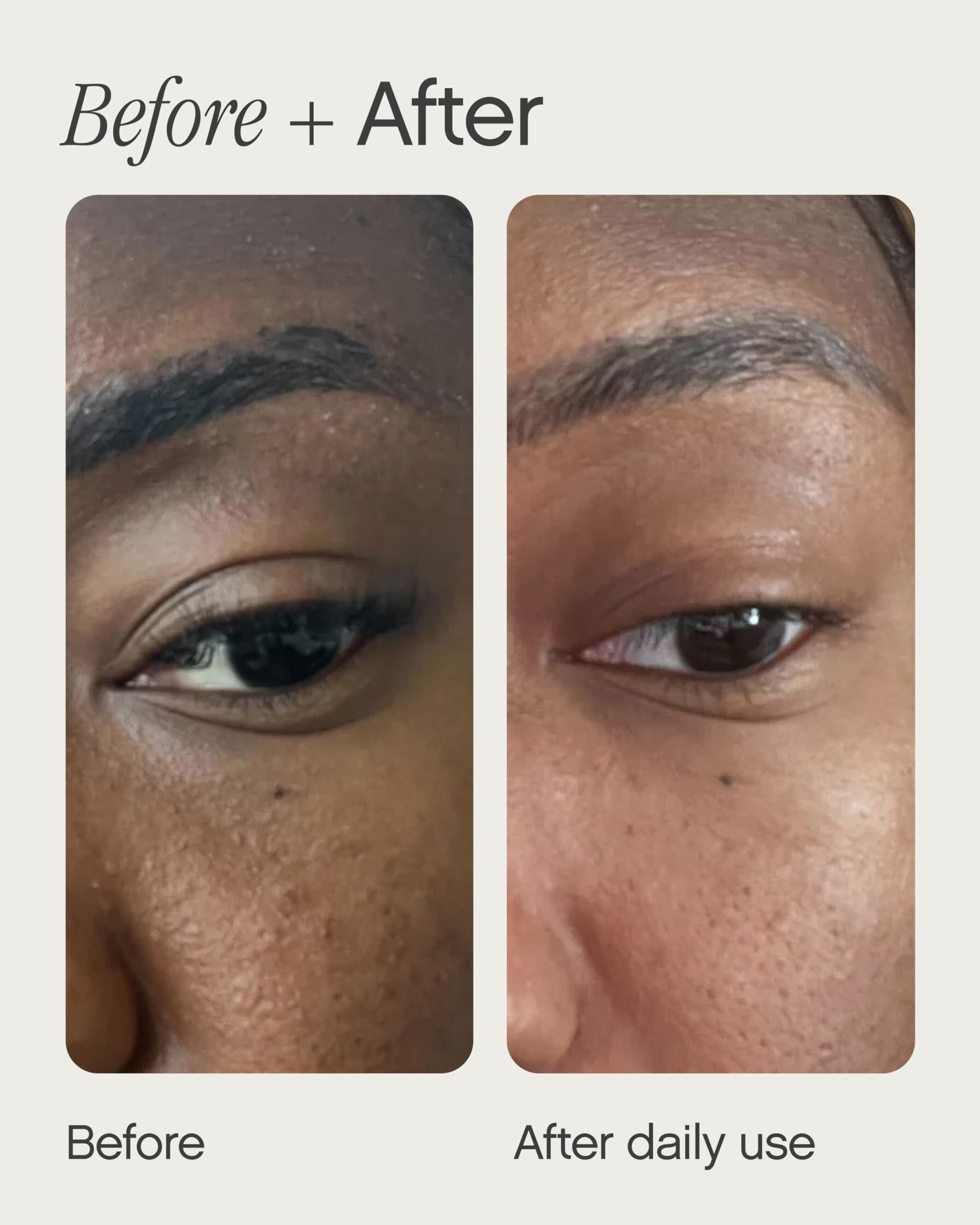 Close-up of texture swirl in Topicals Sealed primer for scar and pore refinement.