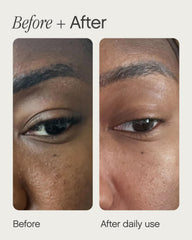 Close-up of texture swirl in Topicals Sealed primer for scar and pore refinement.