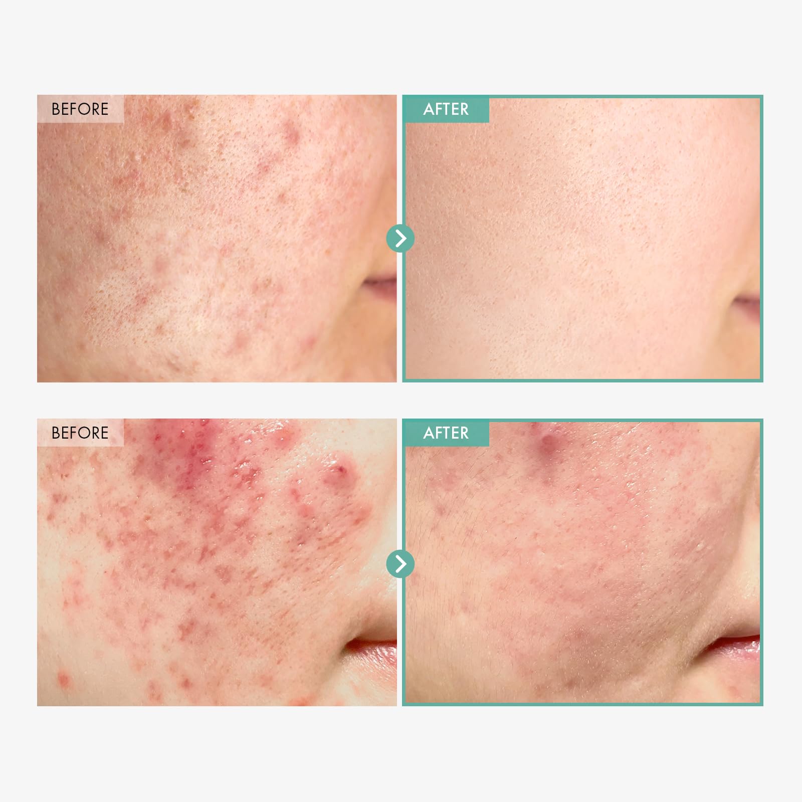 TOSOWOONG Dexpanthenol Cream ingredients panel showing panthenol and centella for skin support.