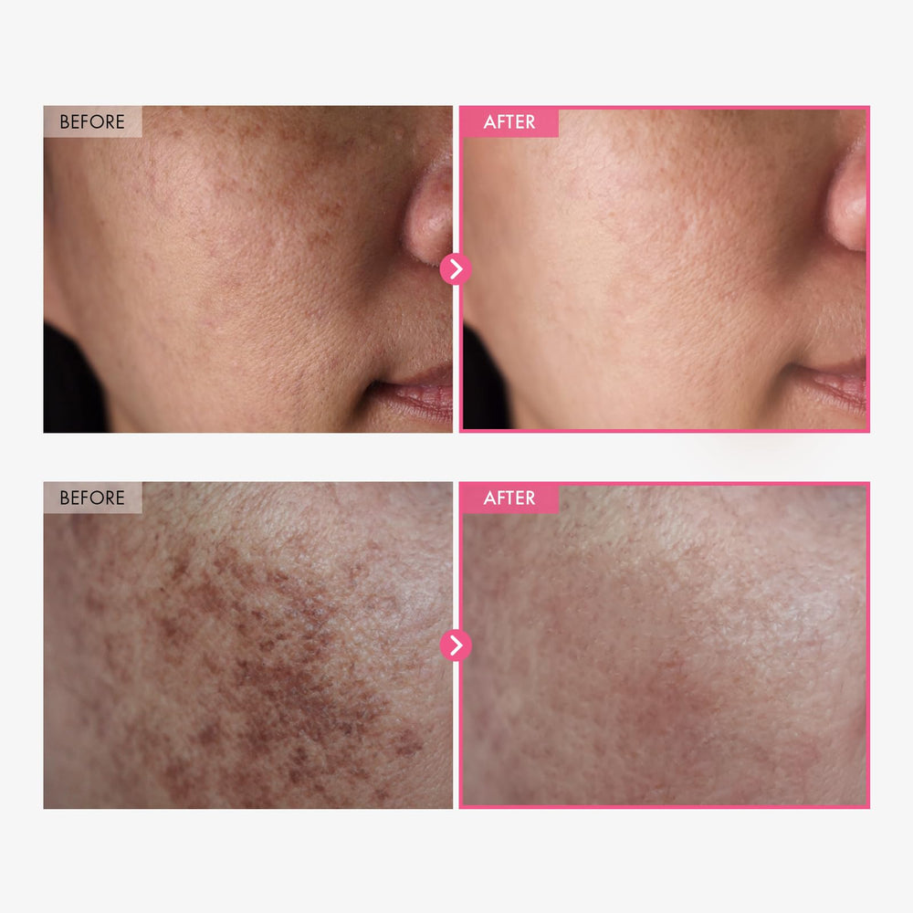TOSOWOONG Arbutin 7% cream label closeup highlights key ingredients and usage.