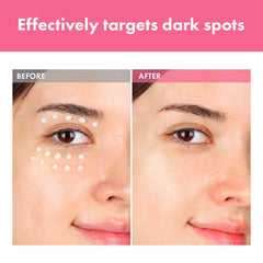 TOSOWOONG Arbutin 7% Spot Cream dispenser highlights easy, precise application.