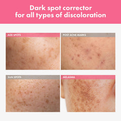 TOSOWOONG Arbutin 7% Spot Cream texture close-up shows creamy, moisturizing consistency.