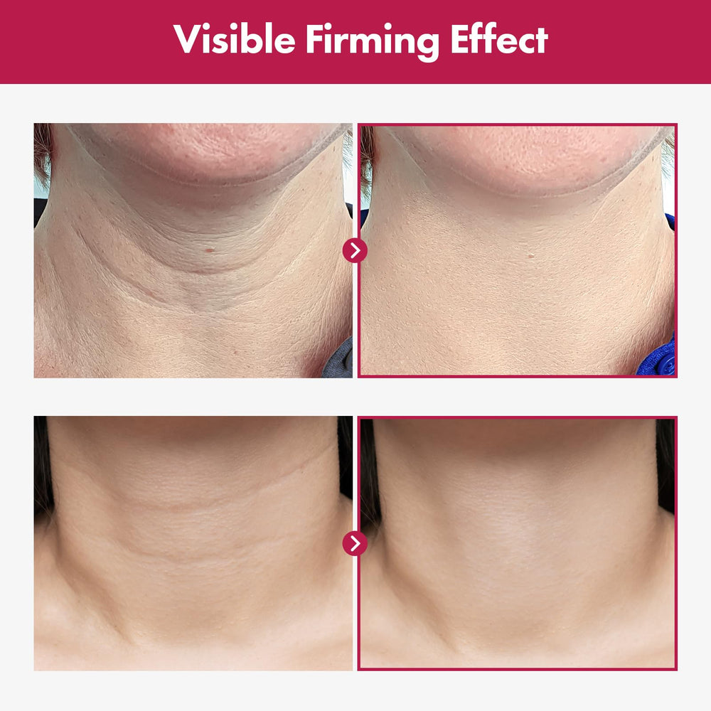 TOSOWOONG Necktox on décolletage helps smooth lines visually during skincare routine.