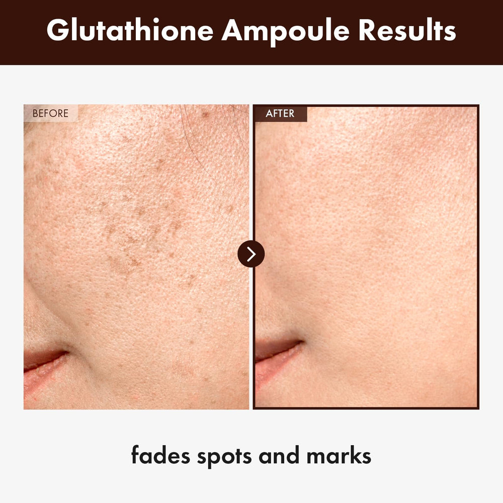 TOSOWOONG Glutathione Serum dropper—easy, precise application for consistent brightening.