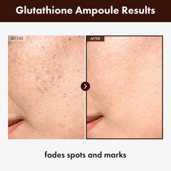 TOSOWOONG Glutathione Serum dropper—easy, precise application for consistent brightening.