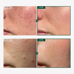 Madagascar Centella 86% ampoule bottle with soothing actives supports gentle redness relief.