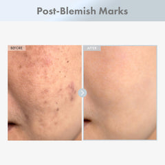 TOSOWOONG Niacinamide 15% serum dropper enables precise dosage