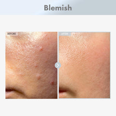 TOSOWOONG Niacinamide 15% serum texture closeup highlights quick absorption
