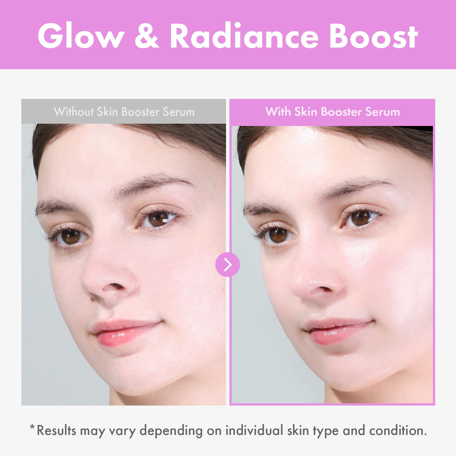 TOSOWOONG Niacinamide and Hyaluronic Acid ingredients label detail.