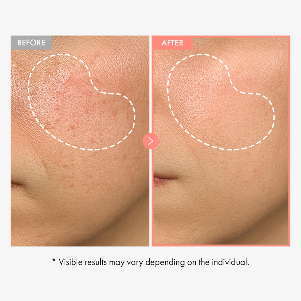 TOSOWOONG Peach 80 Niacin Serum dispenser demonstrates easy, mess-free daily application.