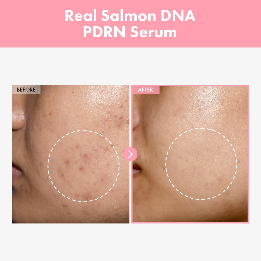 TOSOWOONG Pink Peptide 12 PDRN Serum dropper dispensing precise dose for nourishment