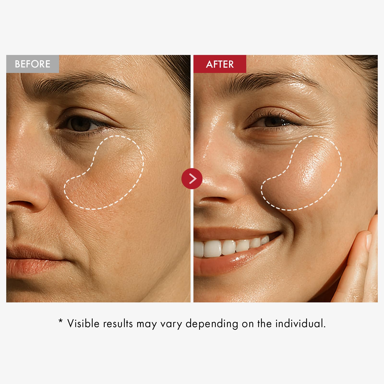 Applying Tosowoong Real Collagen Face Cream to face and neck in massage