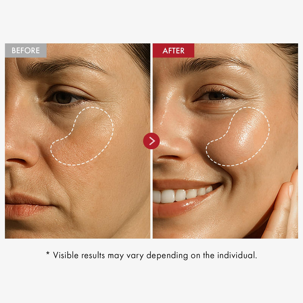 Applying Tosowoong Real Collagen Face Cream to face and neck in massage