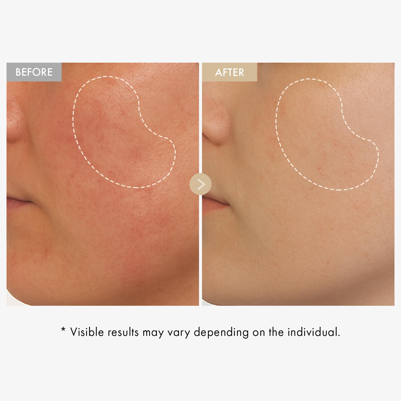 Tosowoong Real Rice Glow Serum dropper pouring demonstrating lightweight hydration for all skin types.