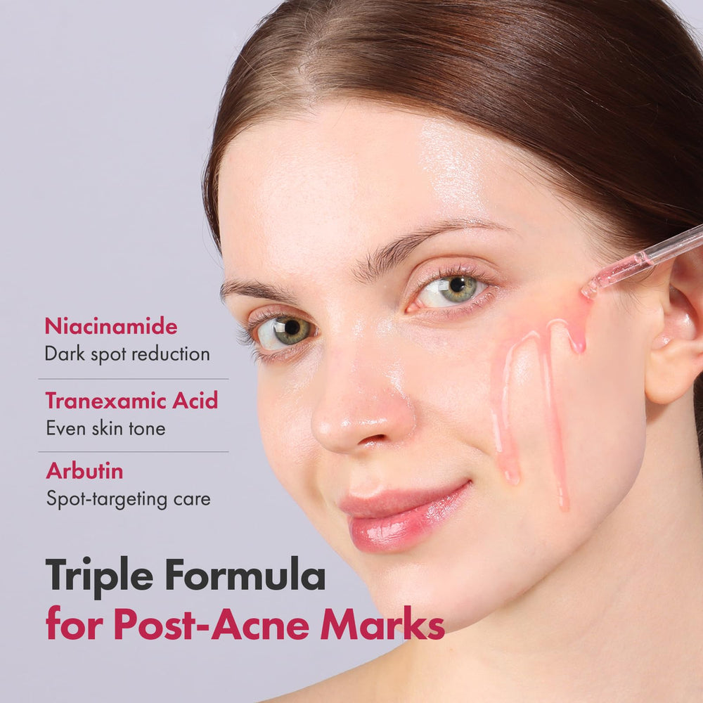TOSOWOONG serum closeup shows ceramide NP and hyaluronic acid for hydrating, barrier-supporting care.