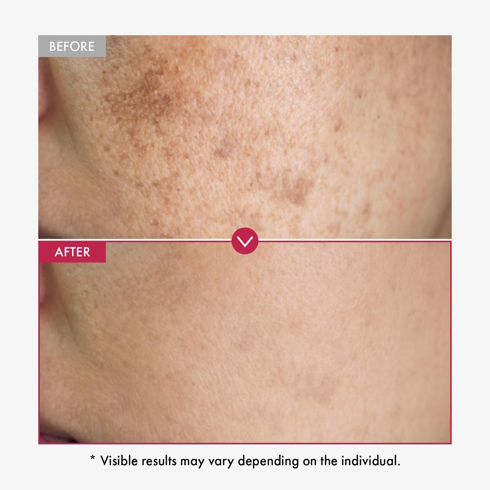 TOSOWOONG lightweight, pink-toned serum texture demonstrated for quick absorption and non-greasy feel.