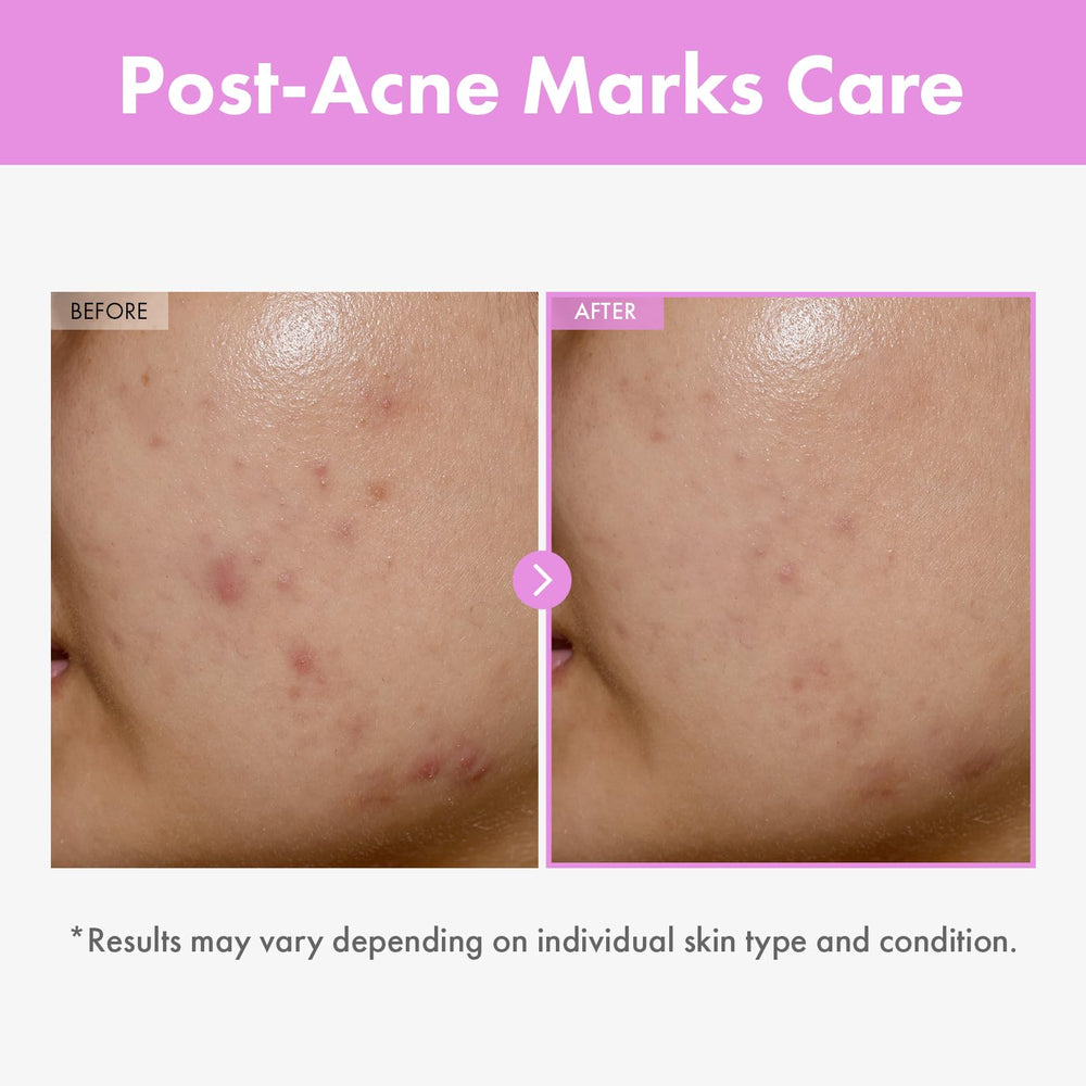 TOSOWOONG serum texture shown as toner-like for fast absorption.