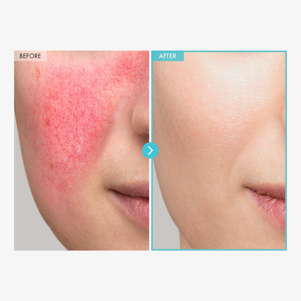 TOSOWOONG SOS Repair zinc-cream ingredients graphic — zinc oxide benefits explained.