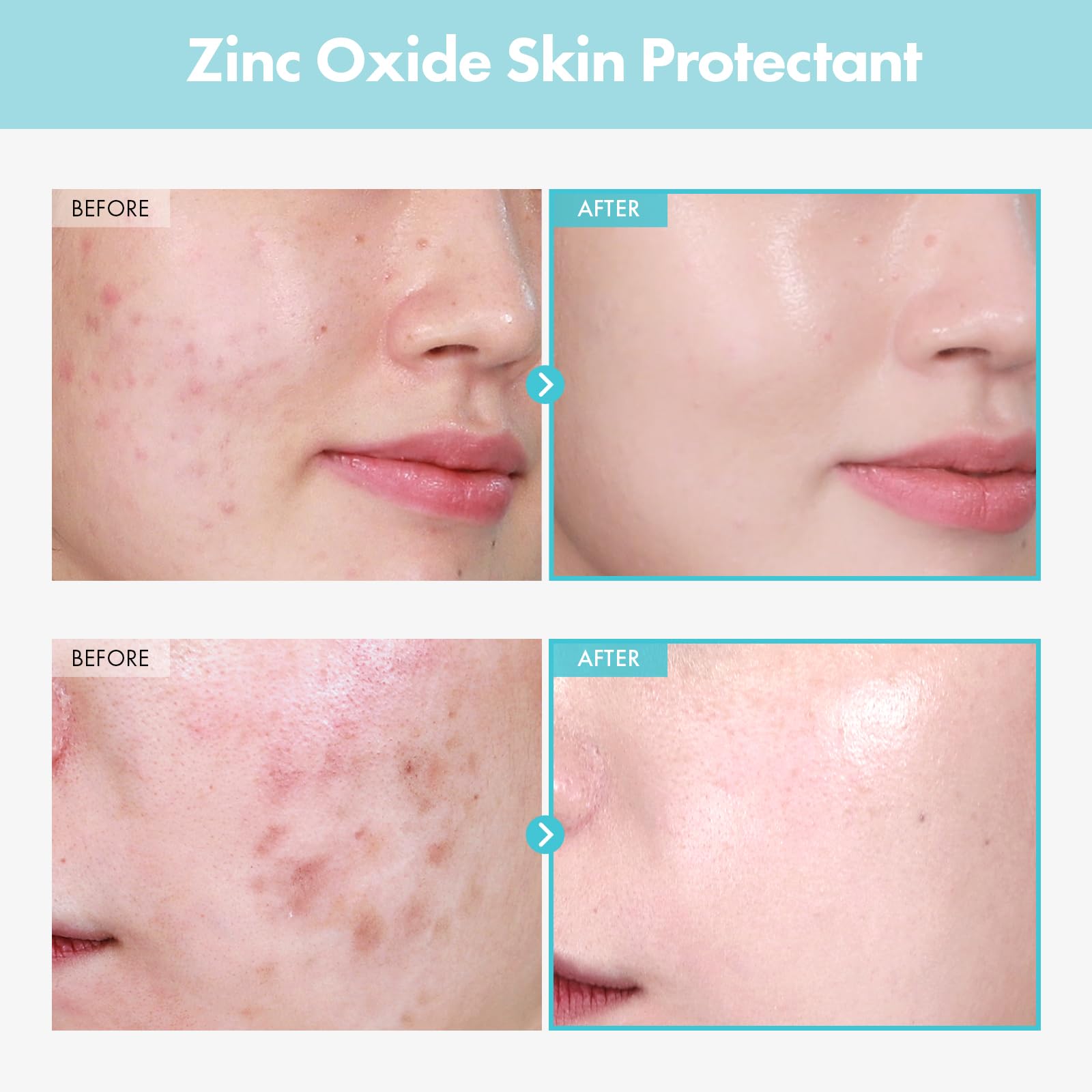 TOSOWOONG SOS Repair zinc-oxide cream swatch on hand — soothing daily skin relief.