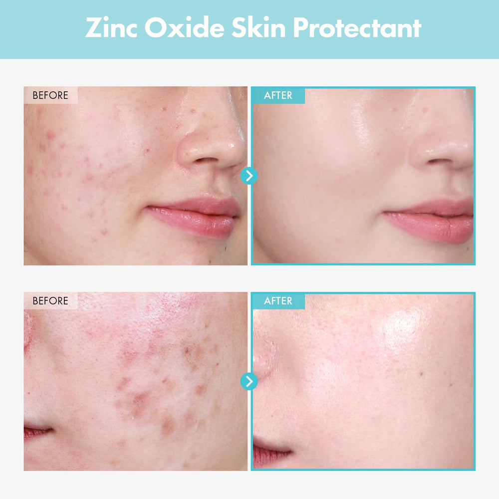 TOSOWOONG SOS Repair zinc-oxide cream swatch on hand — soothing daily skin relief.