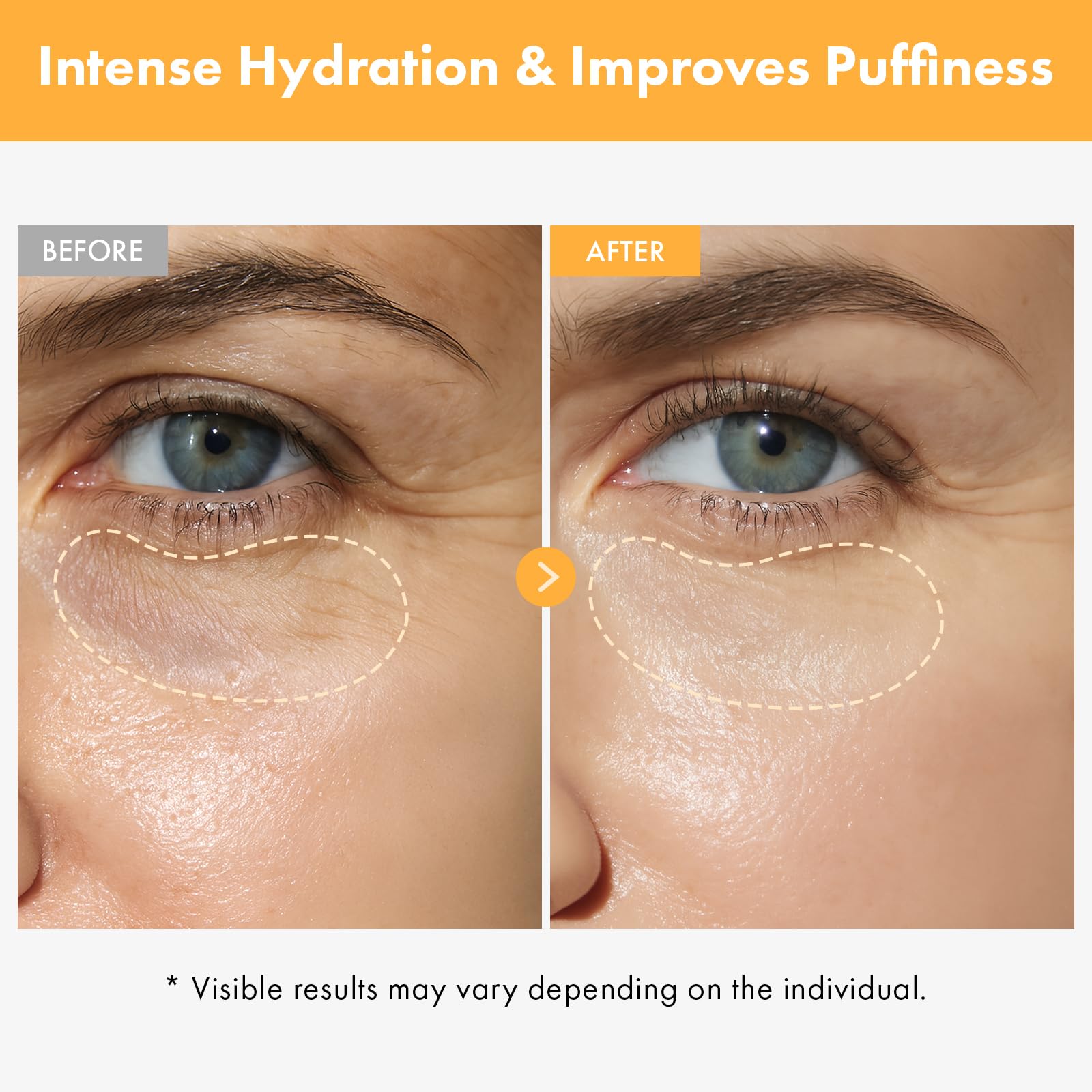 TOSOWOONG Vita Clinic rollerball closeup demonstrates soothing puffiness relief around the eyes.