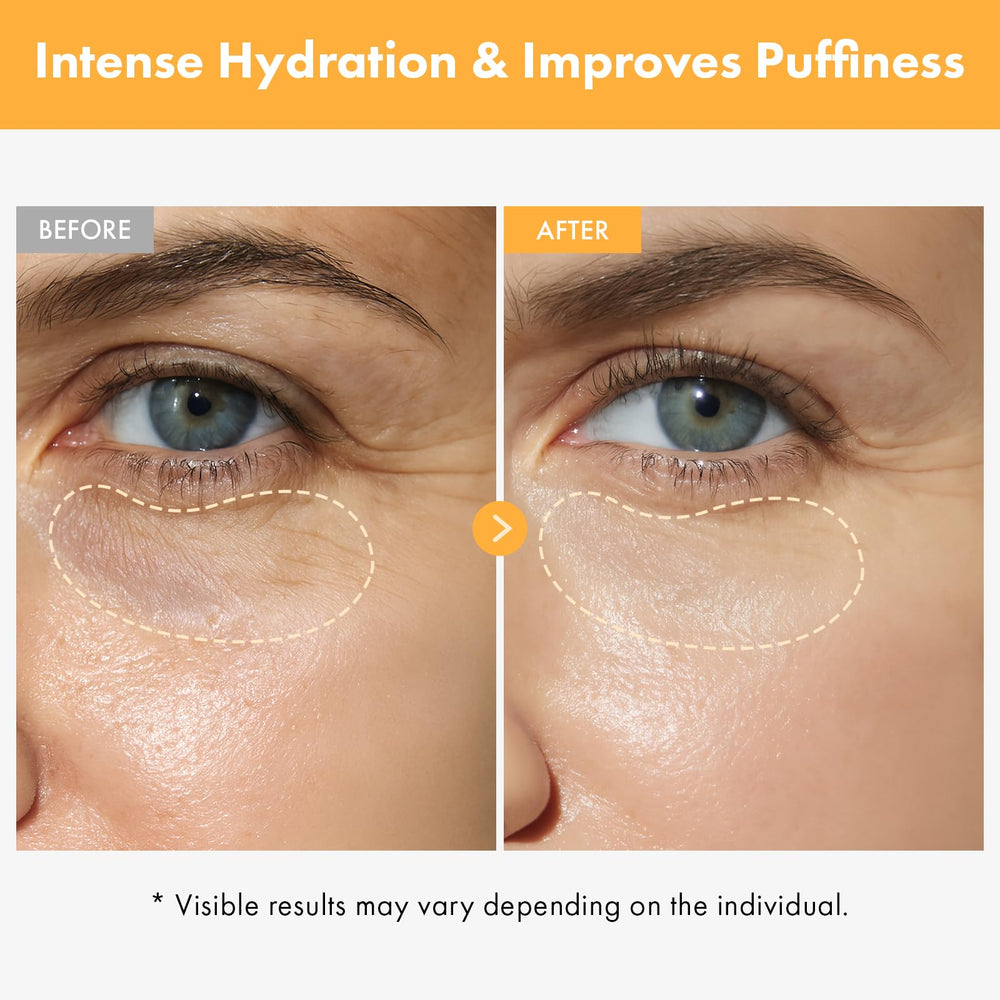 TOSOWOONG Vita Clinic rollerball closeup demonstrates soothing puffiness relief around the eyes.