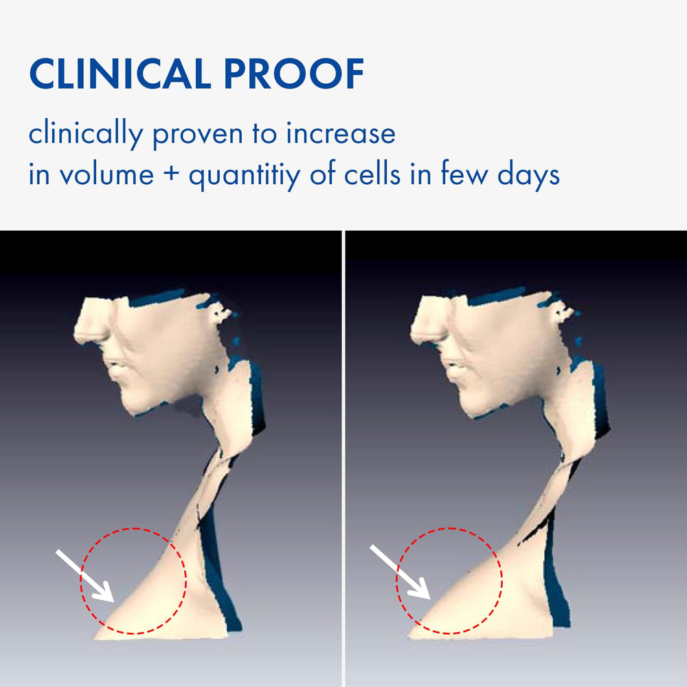 TOSOWOONG Volufiline Serum dispense close-up for easy, precise application.