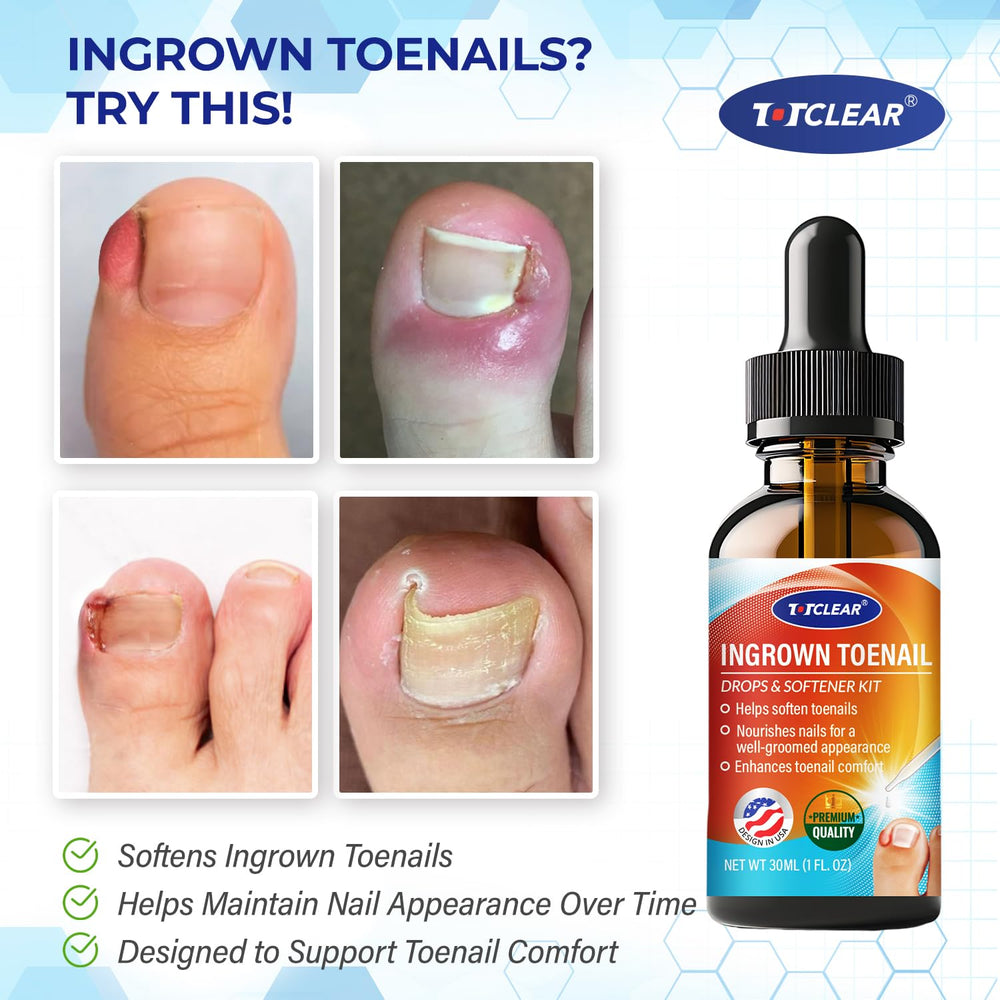 TOTCLEAR softening drops for targeted care around the nail