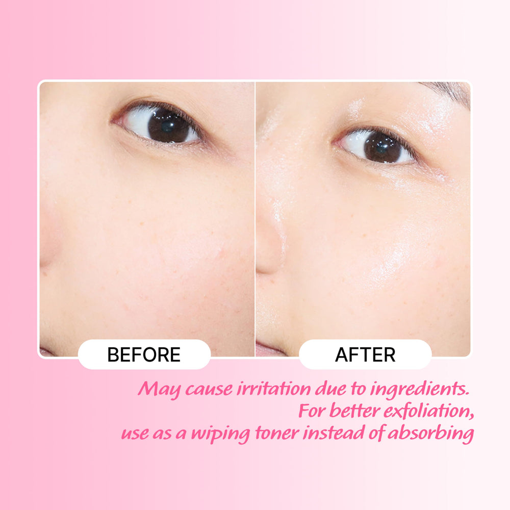 Touch in Sol No Poreblem toner packaging box for premium skincare ritual.
