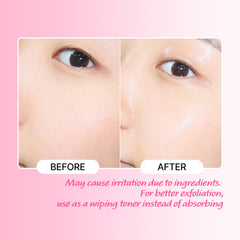 Touch in Sol No Poreblem toner packaging box for premium skincare ritual.