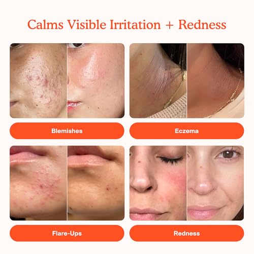 Tower 28 SOS daily rescue facial spray application shown on skin for soothing.